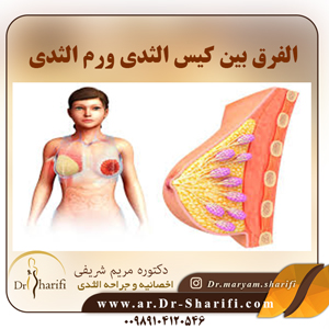الفرق بين كيس الثدي ورم الثدي